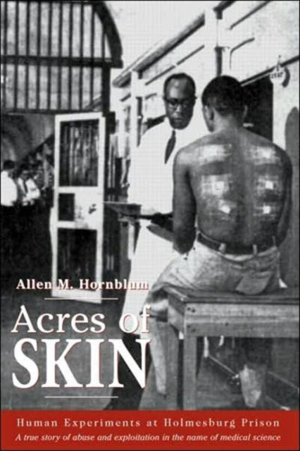 Book cover of: Acres of Skin