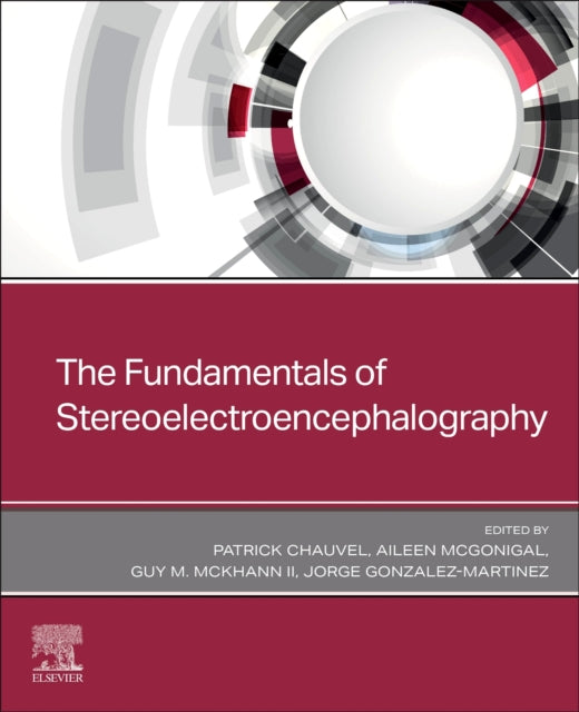 Book cover of: Fundamentals of Stereoelectroencephalography. By: Patrick Chauvel