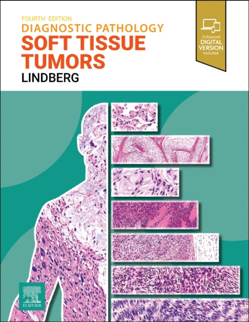 Book cover of: Diagnostic Pathology: Soft Tissue Tumors. By: Matthew R. Lindberg