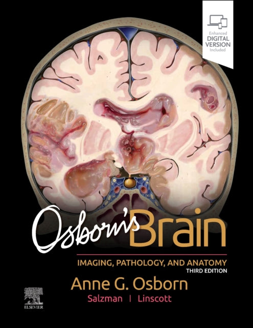 Book cover of: Osborn's Brain. By: Anne G. Osborn