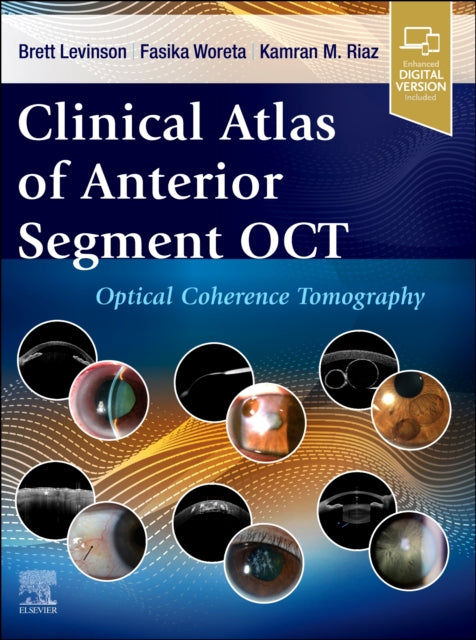 Book cover of: Clinical Atlas of Anterior Segment OCT: Optical Coherence Tomography. By: Brett Levinson