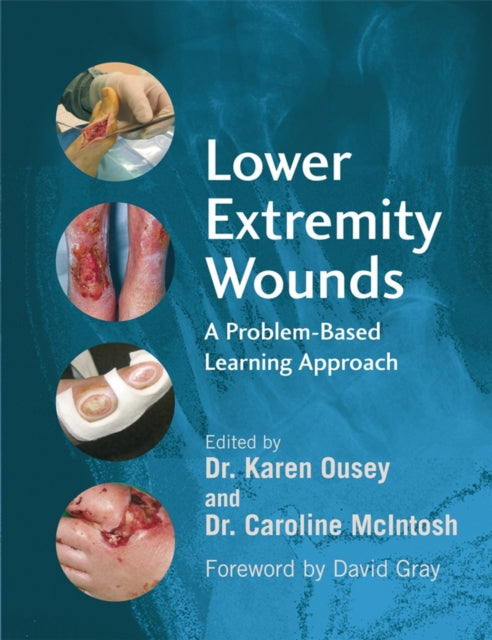 Book cover of: Lower Extremity Wounds