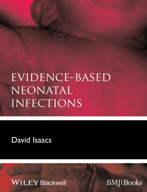 Book cover of: Evidence-Based Neonatal Infections