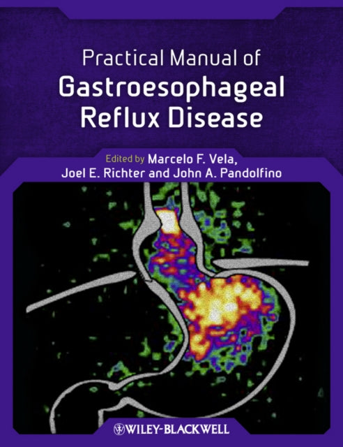 Book cover of: Practical Manual of Gastroesophageal Reflux Disease