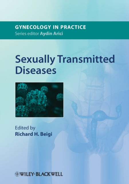 Book cover of: Sexually Transmitted Diseases. By: Richard H. Beigi