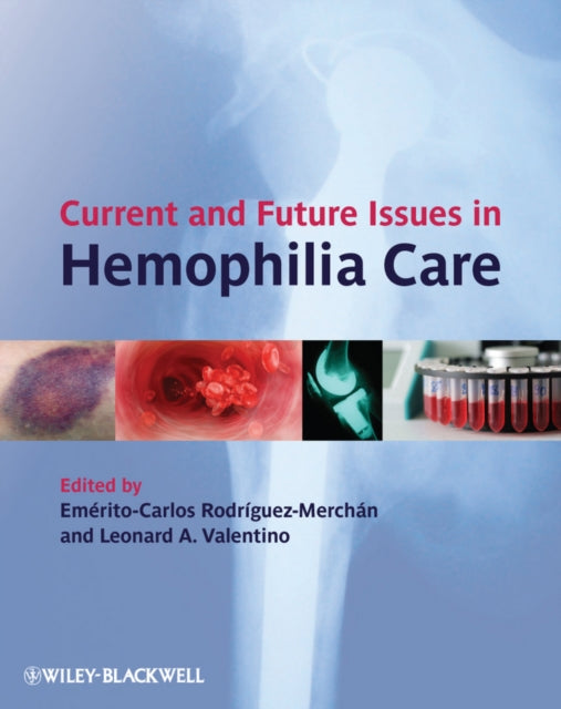 Book cover of: Current and Future Issues in Hemophilia Care. By: E. C. Rodríguez-Merchán