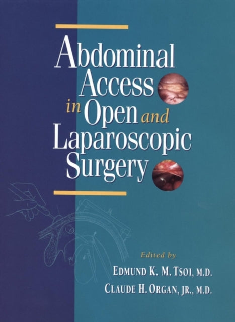 Book cover of: Abdominal Access in Open and Laparoscopic Surgery