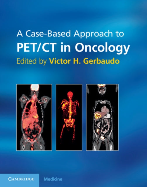 Book cover of: Case-Based Approach to PET/CT in Oncology. By: Victor H. Gerbaudo