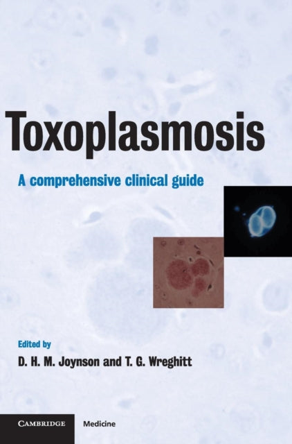 Book cover of: Toxoplasmosis