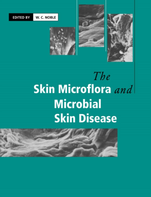 Book cover of: Skin Microflora and Microbial Skin Disease