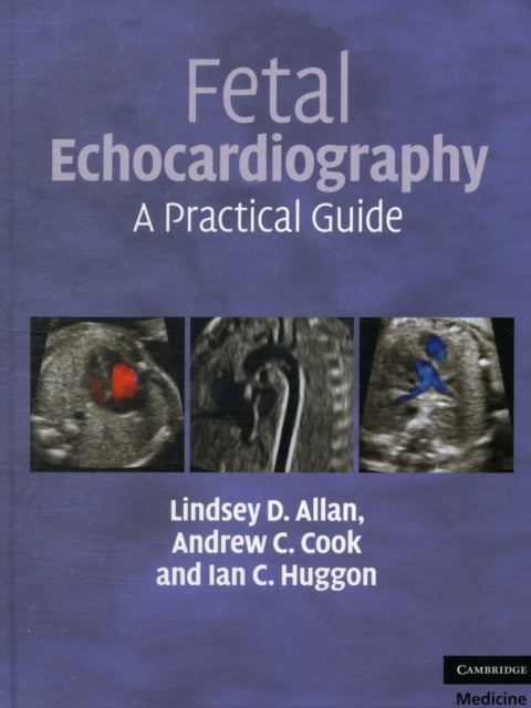 Book cover of: Fetal Echocardiography. By: Lindsey D. Allan