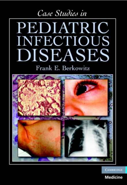 Book cover of: Case Studies in Pediatric Infectious Diseases. By: Frank E. Berkowitz