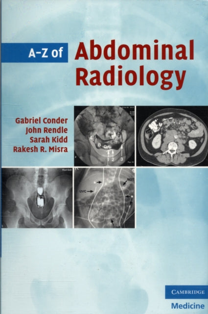 Book cover of: A-Z of Abdominal Radiology. By: Rakesh Misra