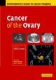 Book cover of: Cancer of the Ovary. By: Rodney Reznek