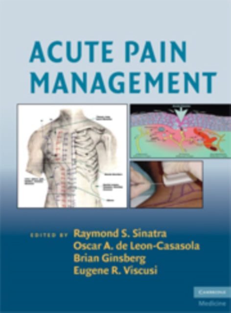Book cover of: Acute Pain Management