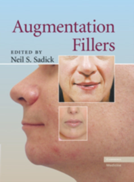 Book cover of: Augmentation Fillers. By: Neil S. Sadick