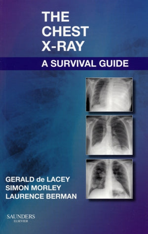Chest X-Ray: A Survival Guide