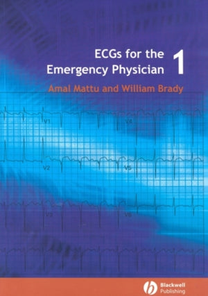 EKG erakorralise meditsiini arstile 1