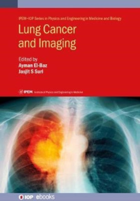 Book cover of: Lung Cancer and Imaging. By: Suri EL-BAZ