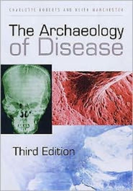 Book cover of: Archaeology of Disease. By: Charlotte A. Roberts