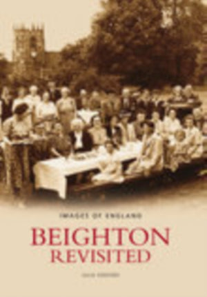 Beighton Revisited