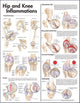 Book cover of: Hip and Knee Inflammations Anatomical Chart