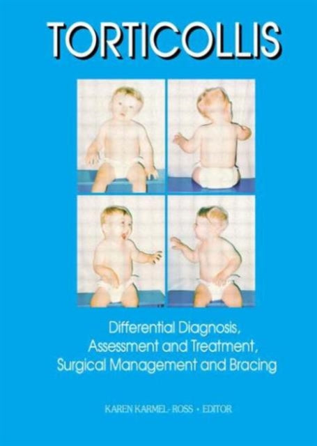 Book cover of: Torticollis. By: Karen Karmel-Ross