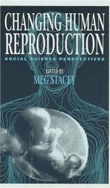 Book cover of: Changing Human Reproduction. By: Meg Stacey