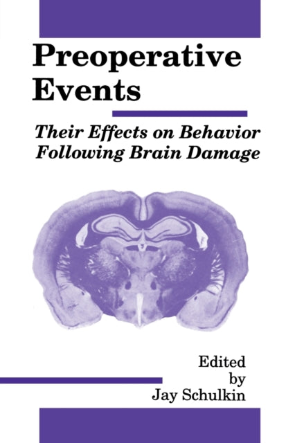 Book cover of: Preoperative Events. By: Jay Schulkin