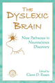 Book cover of: Dyslexic Brain. By: Glenn D. Rosen