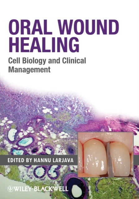 Book cover of: Oral Wound Healing. By: Hannu Larjava