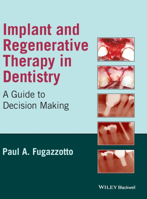 Book cover of: Implant and Regenerative Therapy in Dentistry. By: Paul A. Fugazzotto