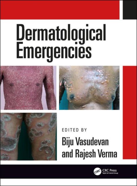 Book cover of: Dermatological Emergencies