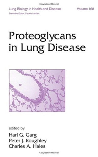 Book cover of: Proteoglycans in Lung Disease. By: GaRg/Roughly/ha