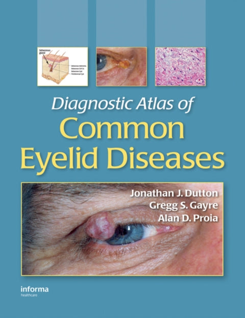 Diagnostic Atlas of Common Eyelid Diseases