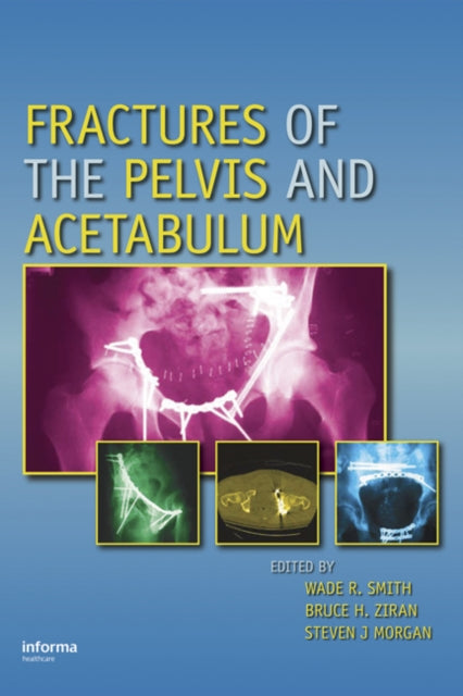 Book cover of: Fractures of the Pelvis and Acetabulum
