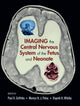 Book cover of: Imaging the Central Nervous System of the Fetus and Neonate