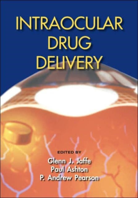 Book cover of: Intraocular Drug Delivery