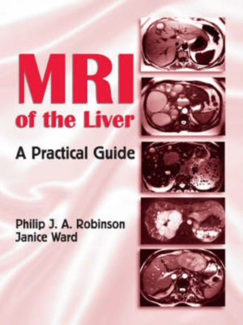 Book cover of: MRI of the Liver. By: Philip J.A. Robinson