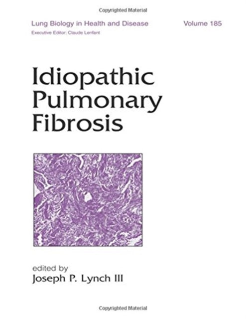 Book cover of: Idiopathic Pulmonary Fibrosis. By: Joseph P. Lynch III