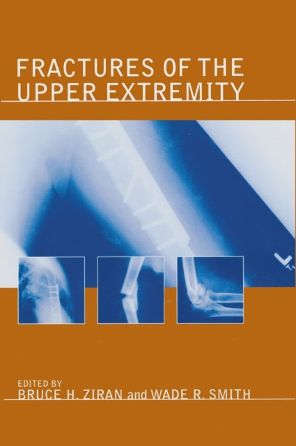 Book cover of: Fractures of the Upper Extremity. By: Bruce H. Ziran
