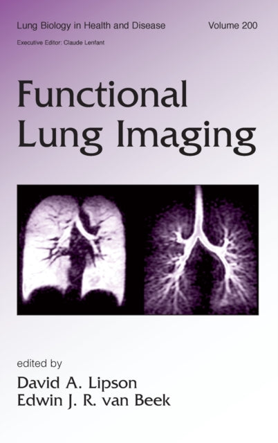 Book cover of: Functional Lung Imaging