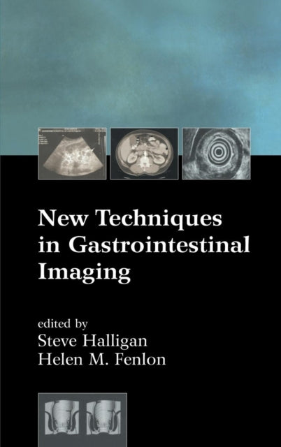 Book cover of: New Techniques in Gastrointestinal Imaging