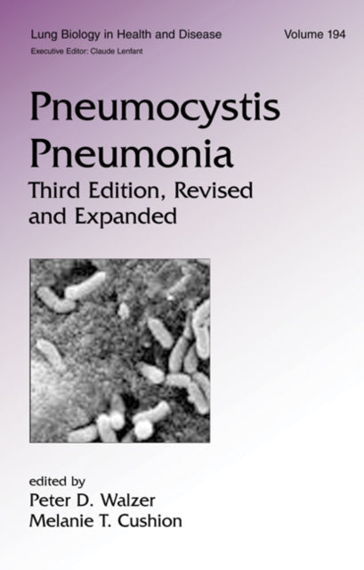 Book cover of: Pneumocystis Pneumonia