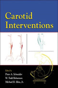 Carotid Interventions