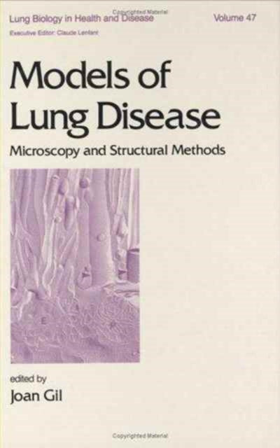 Book cover of: Models of Lung Disease
