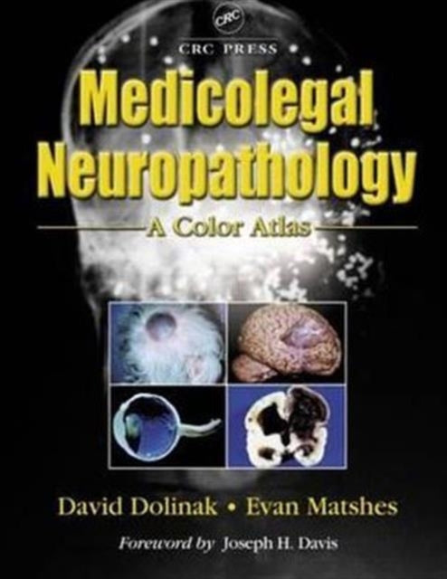 Book cover of: Medicolegal Neuropathology