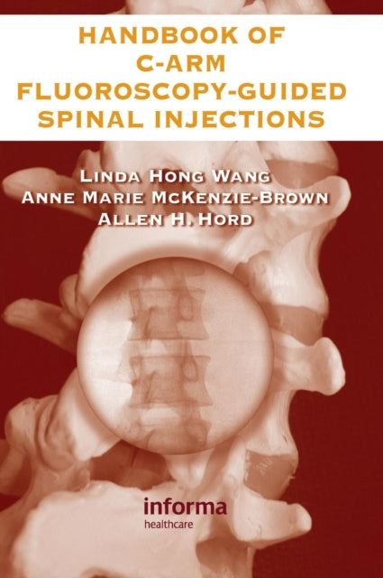 Book cover of: Handbook of C-Arm Fluoroscopy-Guided Spinal Injections