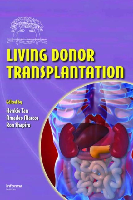 Book cover of: Living Donor Transplantation