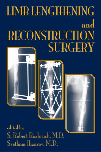 Book cover of: Limb Lengthening and Reconstruction Surgery
